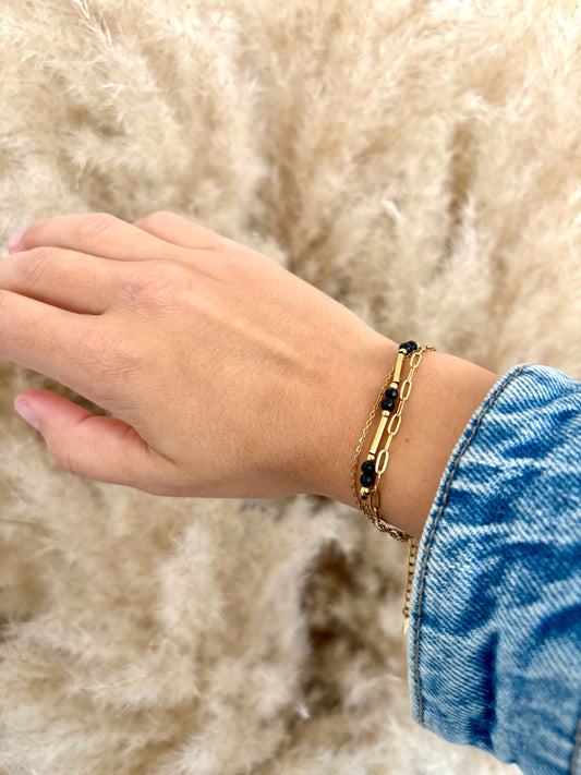 Bracelet cassé : quelles réparations sont possibles et à quel prix ?